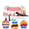 Electric Tooth Polisher, Plaque Remover for Teeth Whitening, Teeth Polishing Kits 4 Speed Modes，Rechargeable Dental Polisher for Cleaning, Waterproof Tooth Polish Tools with 5 Brush Heads& LED Light-4