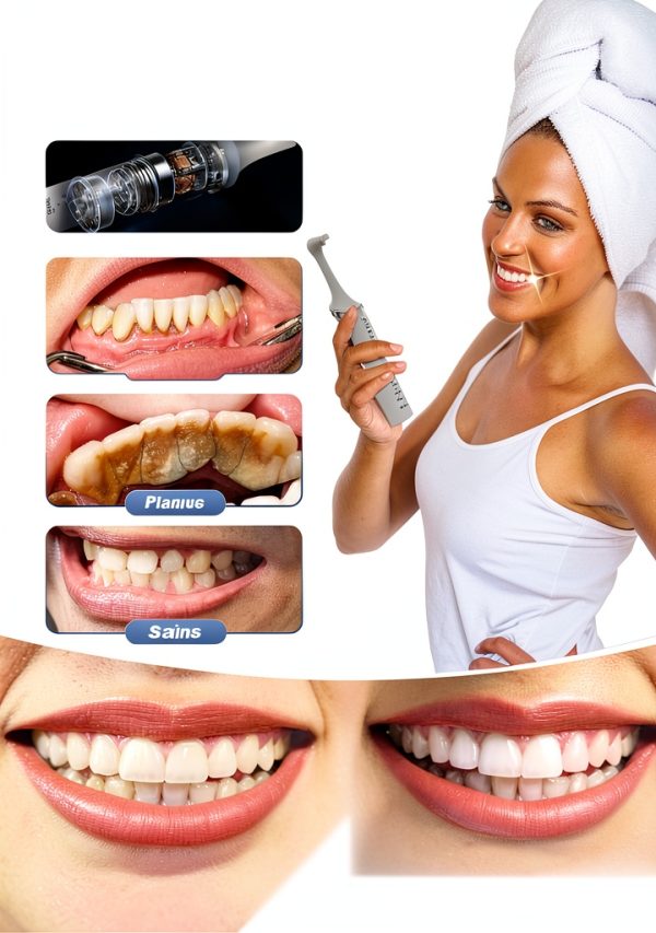 Saker Tooth Polisher P3 Dental Kit LED Light, 5 Speed Modes,-5